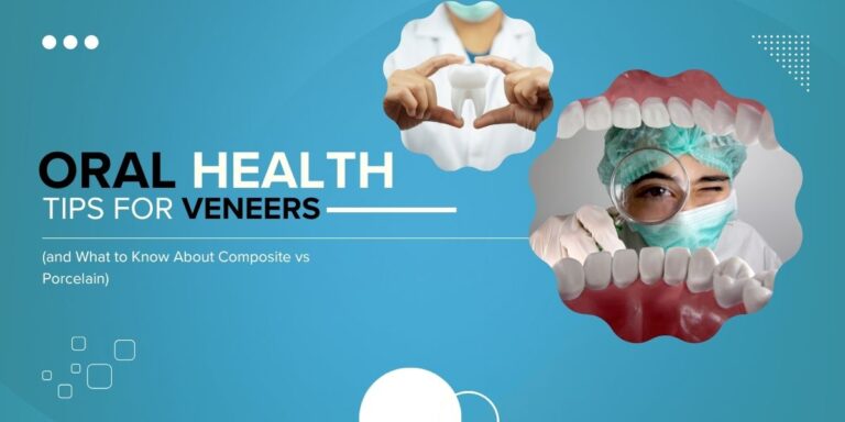 porcelain veneers London