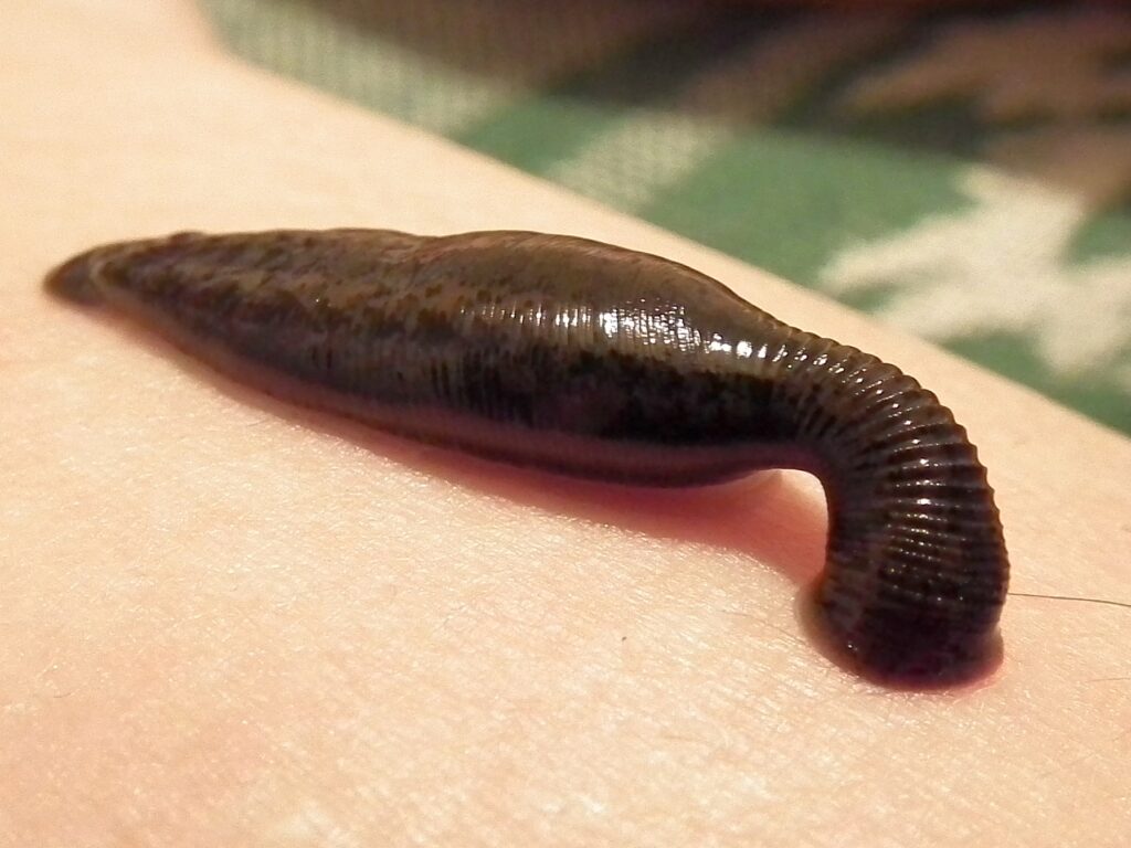 leech therapy Mumbai